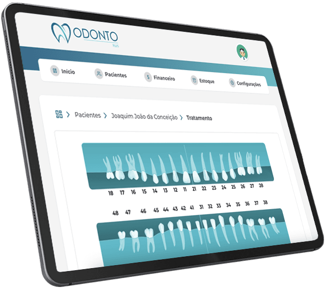 Imagem do tablet na tela de tratamentos do Odonto Plus